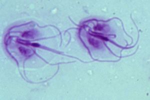 Giardia infectie zwangerschap - homedeluxe.hu Giardia zwangerschap